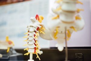 Herniated Disc