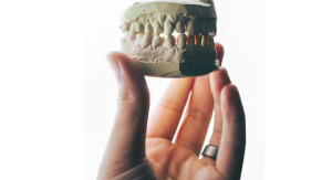 Teeth Black Triangles