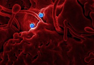 Urinary tract infection